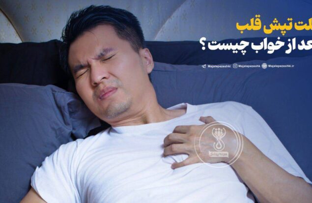 تپش